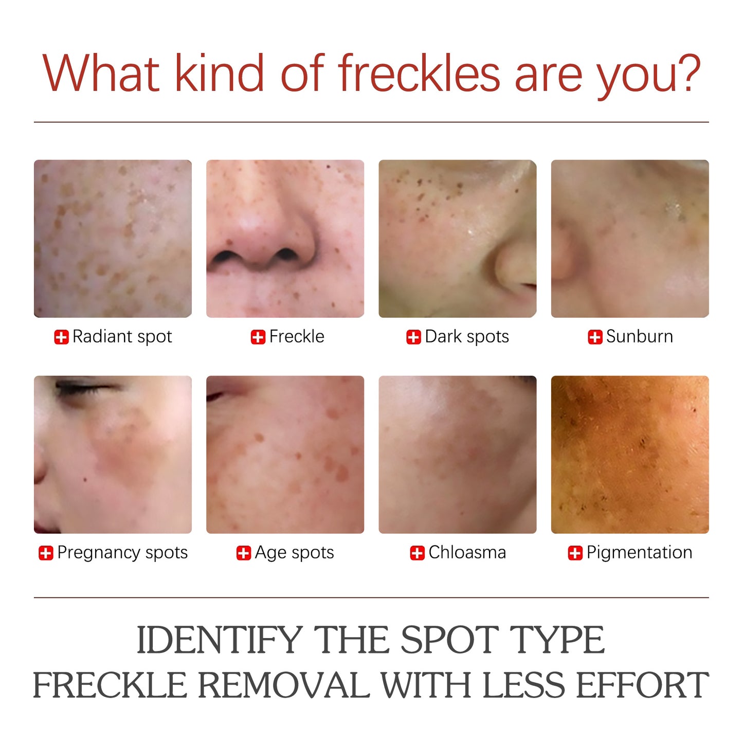 EELHOE Color Repair Cream Replenishes, Moisturizes, And Lightens Freckles, Black Spots, Blemishes, Melasma, And Melanin Skin Cream